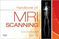 Handbook of MRI Scanning