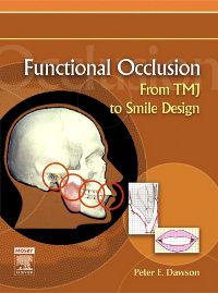 Functional Occlusion