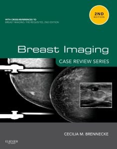 Breast Imaging: Case Review Series