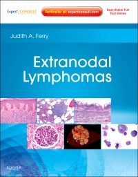 Extranodal Lymphomas