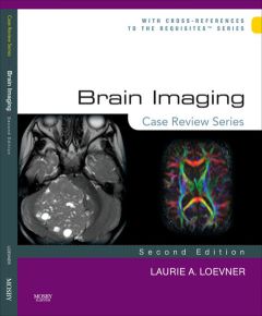 Brain Imaging: Case Review Series