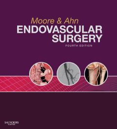 Endovascular Surgery