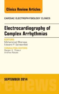 Electrocardiography of Complex Arrhythmias, An Issue of Cardiac Electrophysiology Clinics