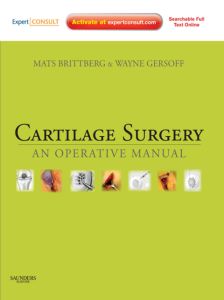 Cartilage Surgery