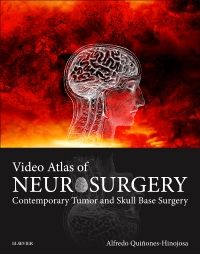 Video Atlas of Neurosurgery