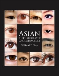 Asian Blepharoplasty and the Eyelid Crease