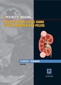 Specialty Imaging: Pitfalls and Classic Signs of the Abdomen and Pelvis E-Book