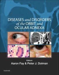 Diseases and Disorders of the Orbit and Ocular Adnexa