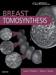 Breast Tomosynthesis