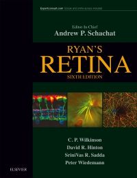 Ryan's Retina