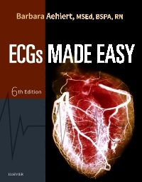 ECGs Made Easy - E-Book