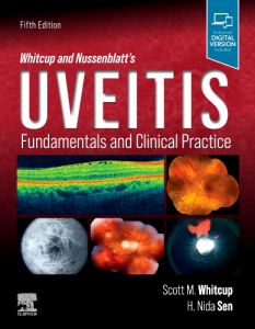 Whitcup and Nussenblatt's Uveitis