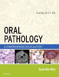 Oral Pathology E-Book