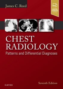 Chest Radiology