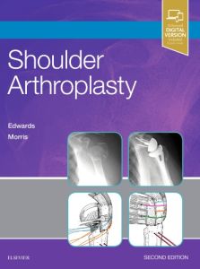 Shoulder Arthroplasty