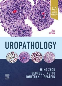 Uropathology