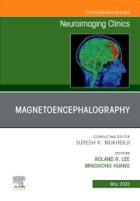 Magnetoencephalography, An Issue of Neuroimaging Clinics of North America