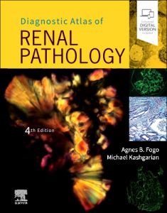 Diagnostic Atlas of Renal Pathology