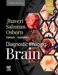 Diagnostic Imaging: Brain