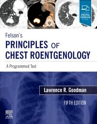 Felson's Principles of Chest Roentgenology