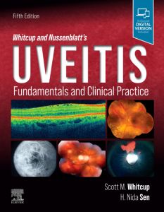 Whitcup and Nussenblatt's Uveitis