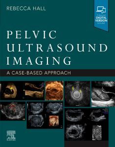 Pelvic Ultrasound Imaging