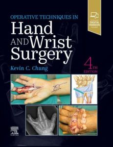 Operative Techniques: Hand and Wrist Surgery