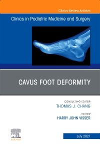 Cavus Foot Deformity, An Issue of Clinics in Podiatric Medicine and Surgery, E-Book