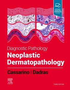 Diagnostic Pathology: Neoplastic Dermatopathology