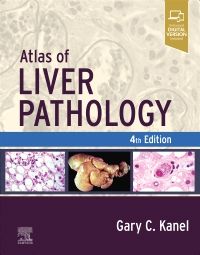 Atlas of Liver Pathology