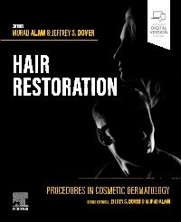 Procedures in Cosmetic Dermatology: Hair Restoration