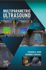 Multiparametric Ultrasound for the Assessment of Diffuse Liver Disease