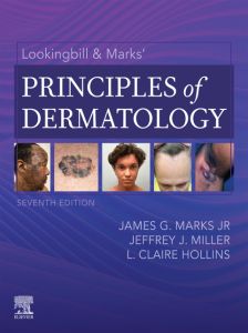 Lookingbill & Marks’ Principles of Dermatology