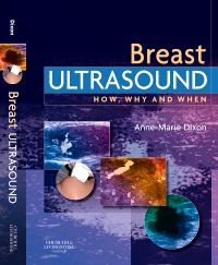 Breast Ultrasound