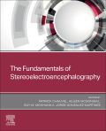 The Fundamentals of Stereoelectroencephalography