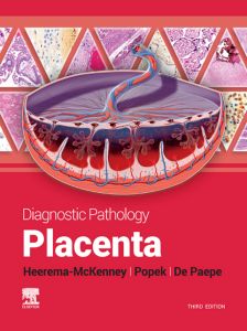 Diagnostic Pathology: Placenta