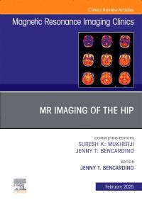 MR Imaging of the Hip, An Issue of Magnetic Resonance Imaging Clinics of North America