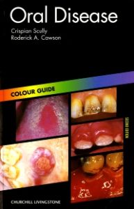 Oral Disease E-Book