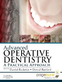 Advanced Operative Dentistry