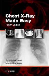 Chest X-Ray Made Easy E-Book