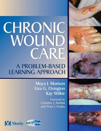 Chronic Wound Care E-Book