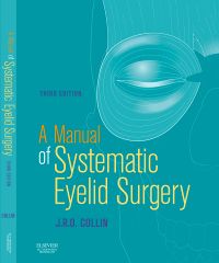 A Manual of Systematic Eyelid Surgery