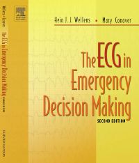 The ECG in Emergency Decision Making