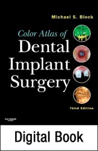 Color Atlas of Dental Implant Surgery - E-Book