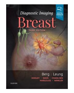 Diagnostic Imaging: Breast