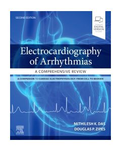 Electrocardiography of Arrhythmias: A Comprehensive Review