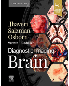 Diagnostic Imaging: Brain