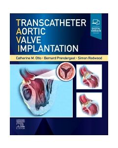 Transcatheter Aortic Valve Implantation