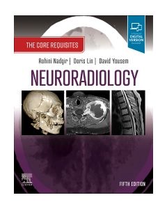 Neuroradiology