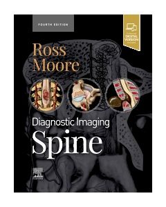 Diagnostic Imaging: Spine